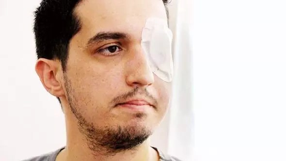 Ministry to pay over 1 million liras to man injured during Gezi